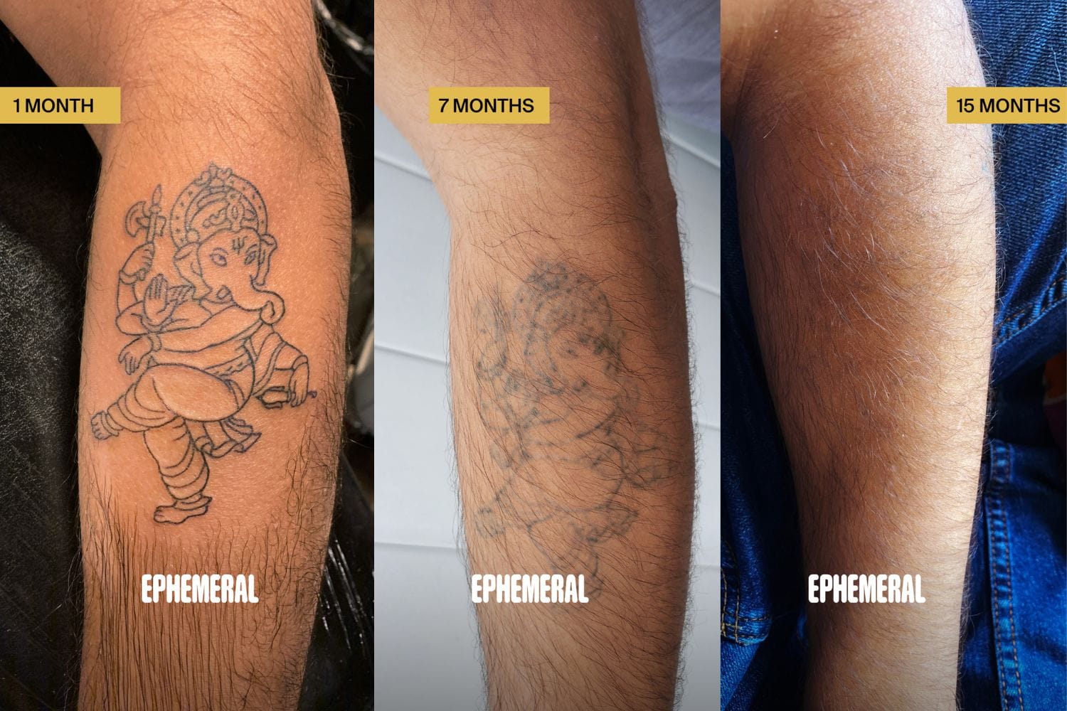 How Bad Do Tattoos Hurt 7 Pain Factors  AuthorityTattoo