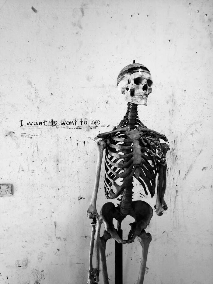 Skeleton Jokes - sad skeleton